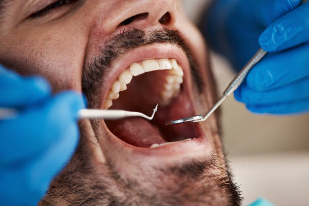 Emergency Dental Services in Redland, AL